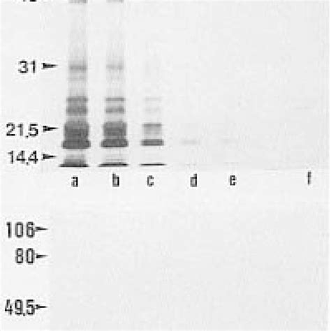 Sodium Dodecyl Sulfate Sds Polyacrylamide Gel Electrophoresis Page Download Scientific