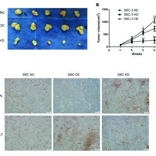 Mir B P Promotes Sclc Development Through The Pten Akt Pathway In