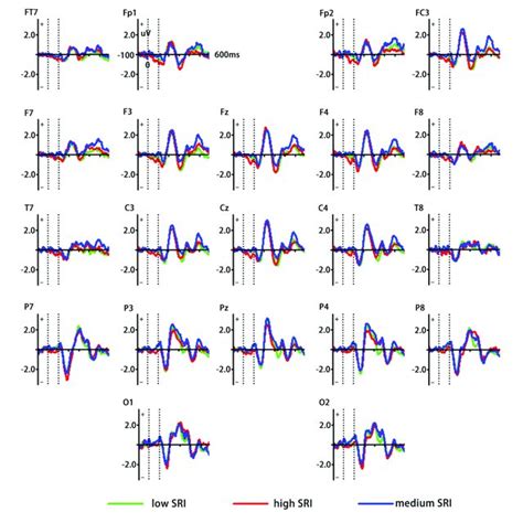 Sample Of The Visual Mismatch Negativity Vmmn Procedure With