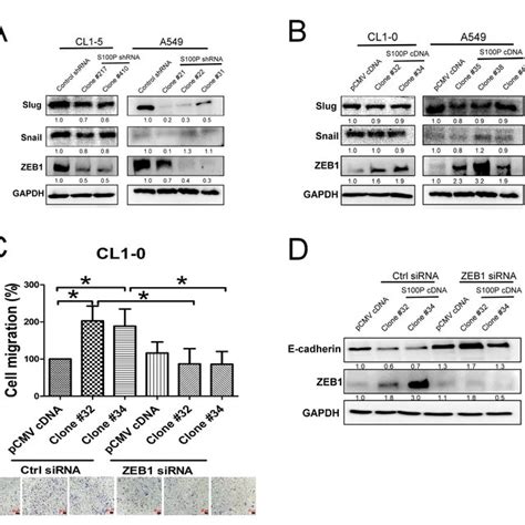 S100P Mediated EMT By ZEB1 The Expression Of EMT Related Transcription