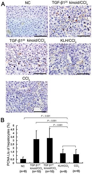 Attenuation Of Ccl4 Induced Hepatic Fibrosis In Mice By Vaccinating