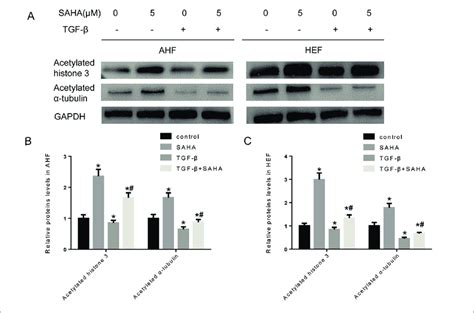 Saha Induces Hyperacetylation Of Histone And Tubulin In Fibroblast