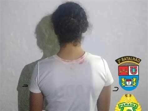 Jovem Atacada Com Soda Cáustica Teve Queimaduras Dentro Da Boca