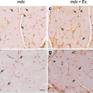 Representative Photomicrographs Of 8 OHdG Immunohistochemistry In