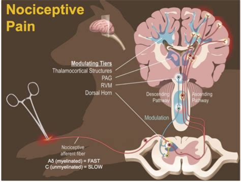 Analgesia Flashcards Quizlet