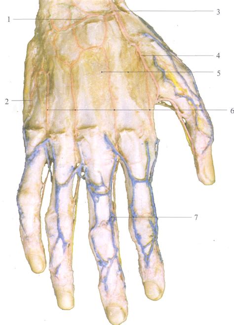 图3 182 掌背和指背的血管2 骨科临床解剖学 医学