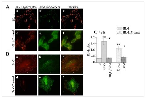 Mitochondrial Membrane Potential Is Disturbed In Cardiomyocytes