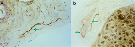 Lachrymal gland. 5'-Nucleotidase staining identifies collapsed ...