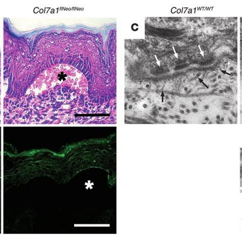 Dermal Epidermal Separation In The Col A Flneo Flneo Mouse Is Caused