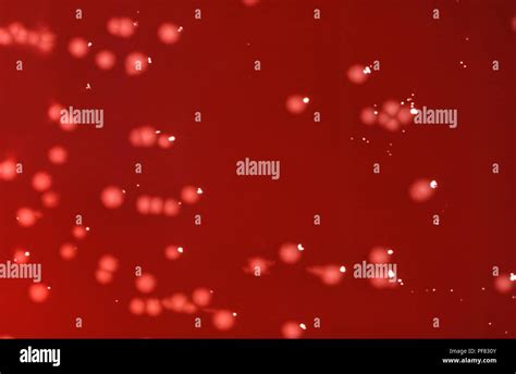 Colonial Morphology Of Gram Negative Facultatively Anaerobic