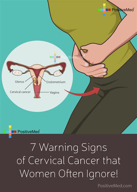 Warning Signs Of Cervical Cancer You Should Never Ignore Newsely Hot