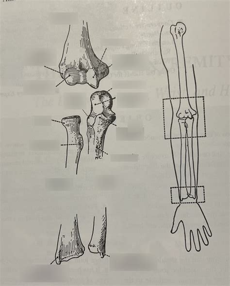 The Bony Structures Of The Elbow And Radioulnar Joints Anterior View