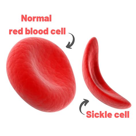 Sickle Cell And Thalassaemia Service