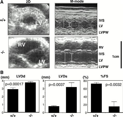 Autoimmune Dilated Cardiomyopathy In PD 1 Receptor Deficient Mice Science