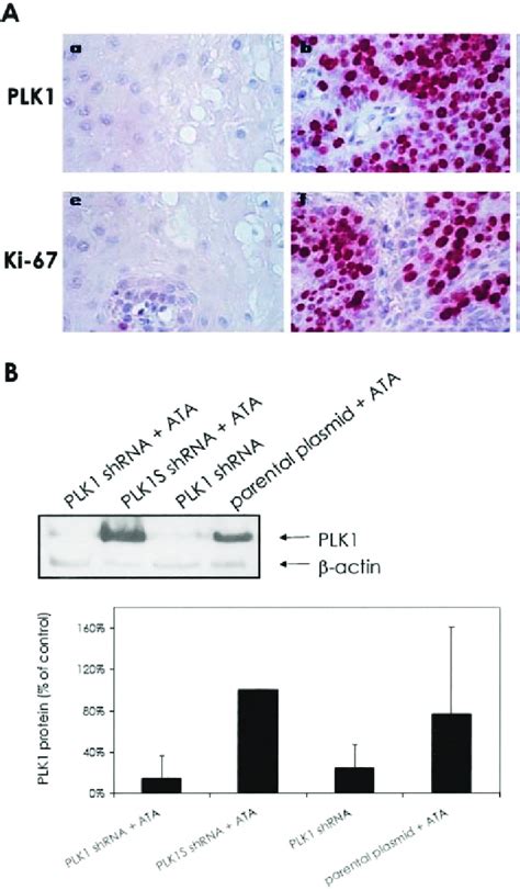 Polo Like Kinase 1 Plk1 Protein Expression And Cell Proliferation In Download Scientific