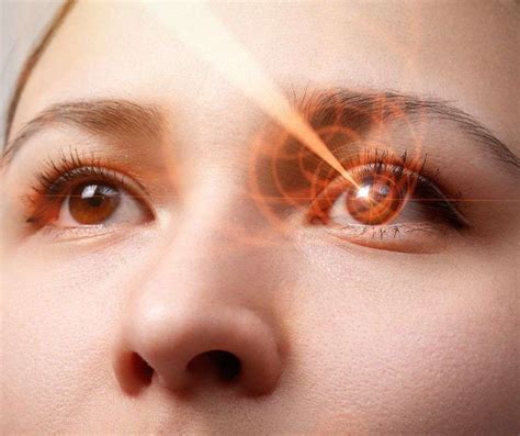 Laser In Eye Explore Laser Eye Treatment And Clear Vision Ahead