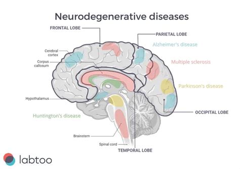 Keeping Your Brain Sharp How To Care For Your Aging Brain Health Direct