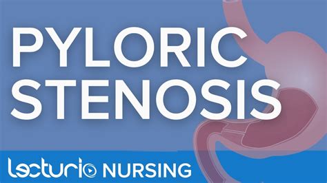 Pyloric Stenosis Definition Signs Symptoms Treatment Lecturio