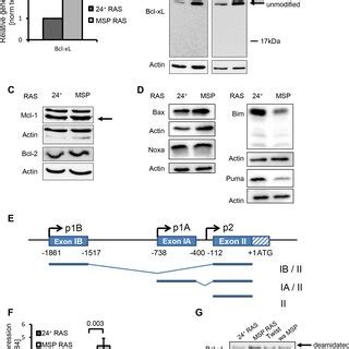 Bcl XL Protein Levels Are Increased In Human Breast Cancer Cells That