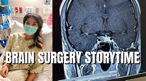 I Had Brain Surgery Removing Pituitary Tumor Youtube