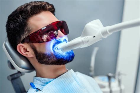 Cuales son las preguntas más frecuentes sobre blanqueamiento dental