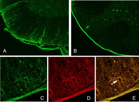 Spinal Cord Sections From Mouse 24 Hours After 4 Injections Of Nmo Igg Download Scientific