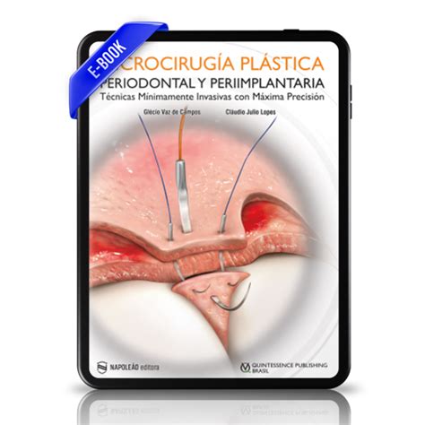 Ebook Campo Lopes Microcirug A Pl Stica Periodontal Y