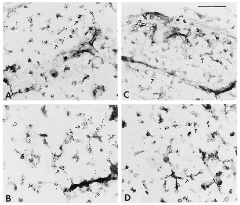 Localization Of Caveolin And Enos In Plasma Membranes By Immunoelectron Download Scientific