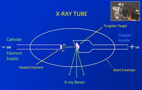 Radiation Physics And Xray Production Flashcards Quizlet