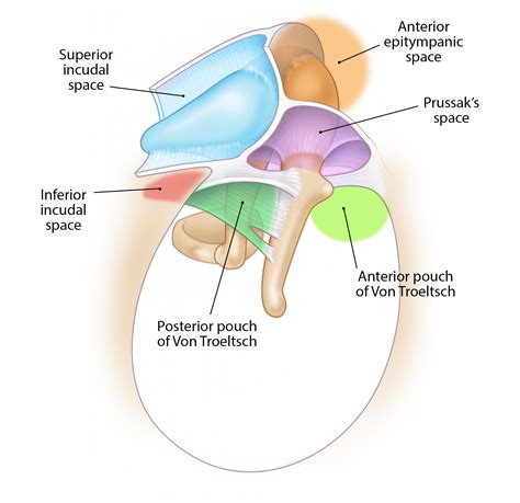 Growth Patterns of Cholesteatoma – Oto Surgery Atlas