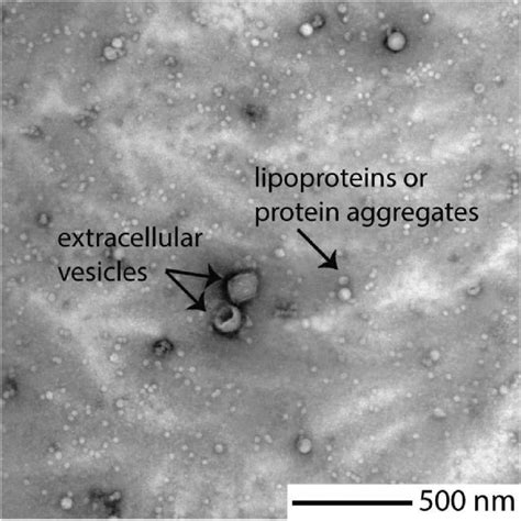 Transmission electron microscopy image of extracellular vesicles in ...