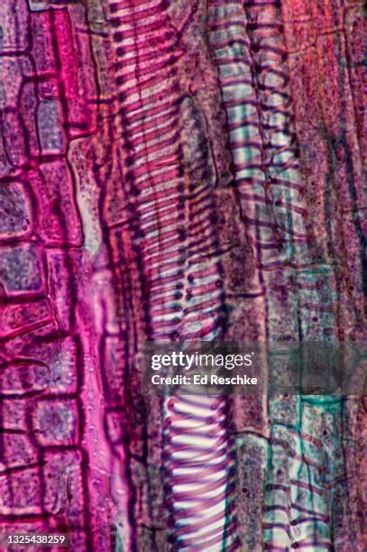 Xylem Vessel Photos and Premium High Res Pictures - Getty Images