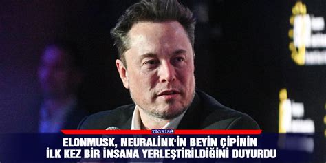 Elon Musk Neuralink in beyin çipinin ilk kez bir insana