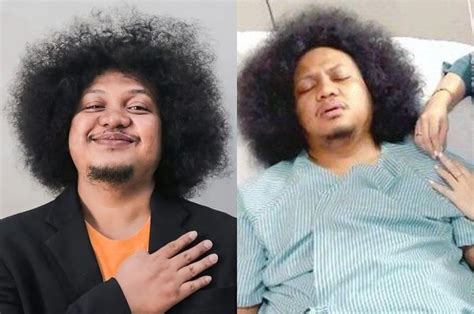 Mengenal Anemia Aplastik Penyakit Langka Yang Diderita Babe Cabita