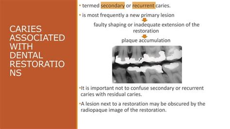 Radiographic Of Interpretation Of Dental Caries Ppt