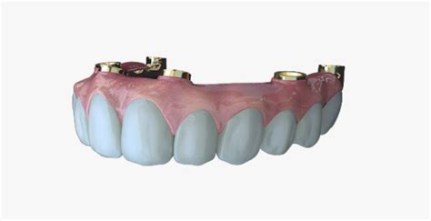 Evo 3d Printed Dental Implants Secure £4 Million Investment 3d