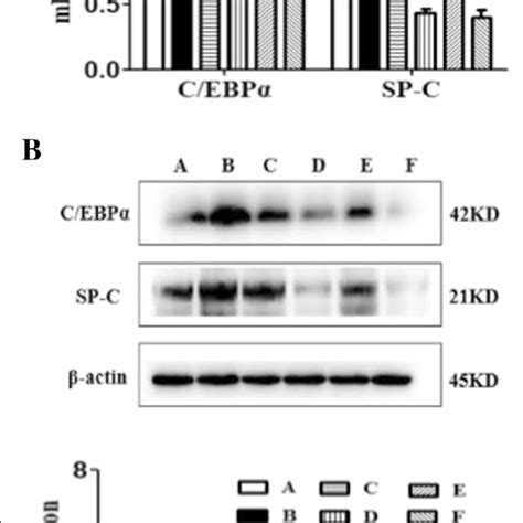 Abbreviations AEC II Alveolar epithelial type II C EBPα