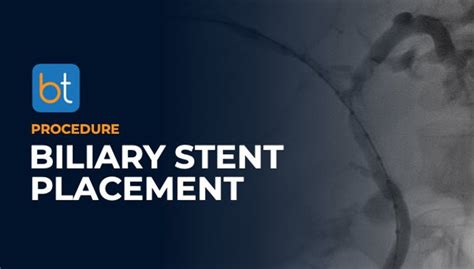 Biliary Stent Placement Procedure Prep | BackTable VI