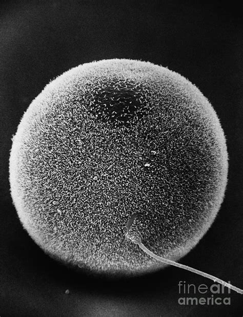 Human Sperm Fertilizing Hamster Egg Sem Photograph By David M Phillips