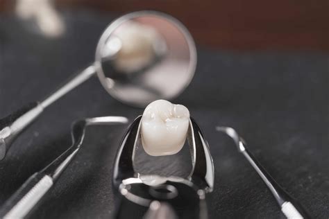 Woodland Hills Dentist Looks At How We Extract A Tooth Woodland Hills CA