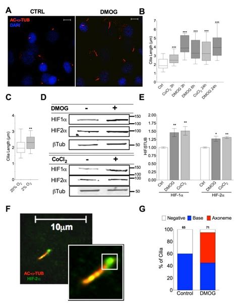 Prolyl Hydroxylase Inhibition And Hypoxia Increases Cilia Length And Is