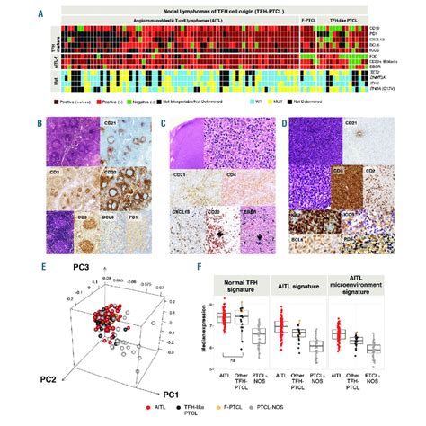 Morphological Immunophenotypical And Molecular Features Of Aitl And