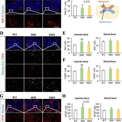 Smn Aso Suppressed Microglial Expression In The Spinal Cord Of Smnd