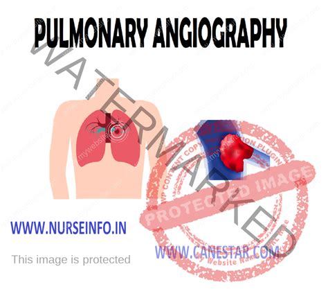 PULMONARY ANGIOGRAPHY - Nurse Info