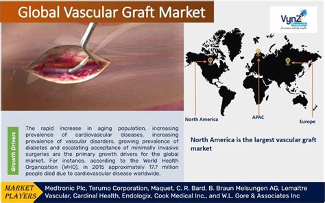 Vascular Graft Market Size Share Growth Report 2030