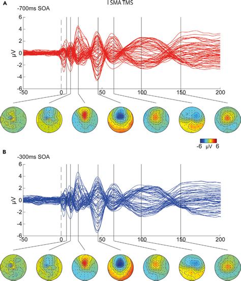 Grand Average Results From Sensor Space TEPs Analyses After SMA