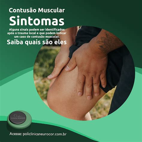 O Que É Uma Contusão - Saiba como identificar uma contusão muscular
