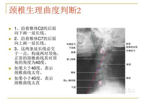 颈椎x线诊断 平高医院康复科 赵铎 Ppt Download