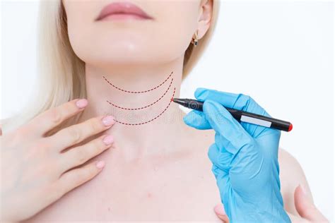 Woman Shows Her Neck for Plastic Surgery. Stock Photo - Image of ...