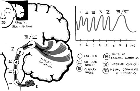 Experiment The Auditory Brainstem Response